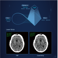 CT Scanners Supplier